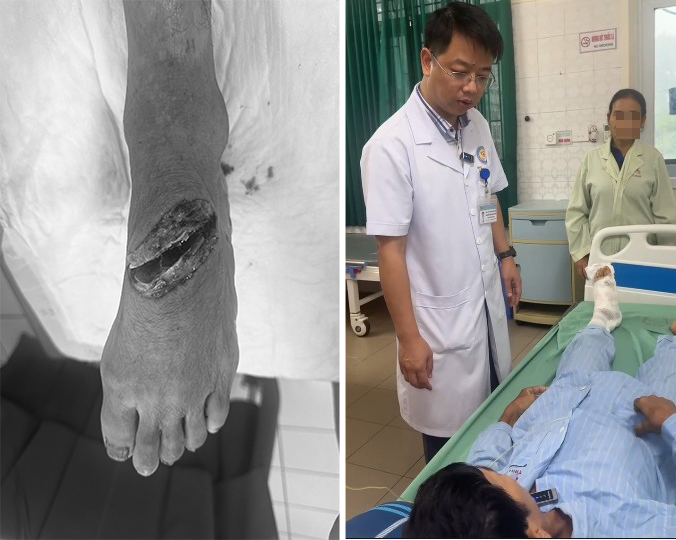  Cảnh báo tai nạn lao động khi sử dụng máy cắt cỏ